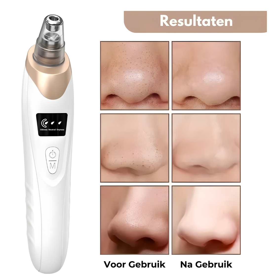 FaceClear - By Mabeauty